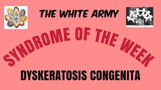 Syndromeoftheweek  DYSKERATOSIS CONGENITA  THE WHITE ARMY [upl. by Irrehc]