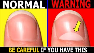 What The Half Moon on Fingernails Means  THIS WILL SHOCK YOU [upl. by Stoops988]