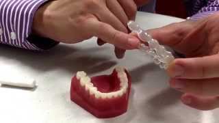 Sharp edges with your Invisalign plates how and what to do Dr Andrew Chang Smiles amp Faces Ortho [upl. by Neeloj219]