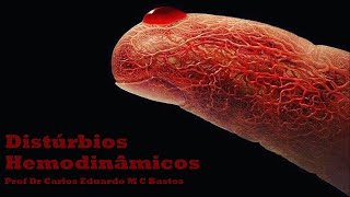 PATOLOGIA GERAL  Distúrbios Hemodinâmicos [upl. by Brinkema]