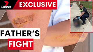 Father left bruised after chasing down teens who allegedly burgled his home twice in one day  7NEWS [upl. by Emory142]