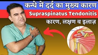 How to RELIEVE SUPRASPINATUS TENDONITIS  SHOULDER PAIN RELIEF EXERCISES [upl. by Hernardo]