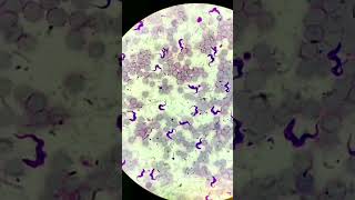 Trypanosoma under microscope microscopic parasitology Trypanosomiasis [upl. by Marcie]