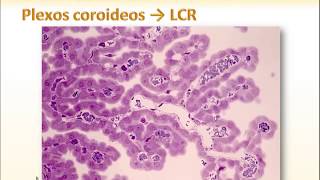 13 LCR y Plexos coroideos [upl. by Naamana]