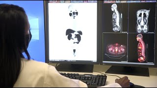 PSMA PET Scan Used For Prostate Cancer – Memorial Cancer Institute [upl. by Wilek]