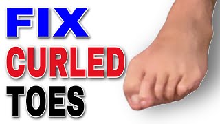 Hammer Toe Exercises and Stretches to Straighten curled toes [upl. by Adym]