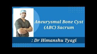 Aneurysmal Bone Cyst ABC Sacrum Treatment  Surgery  What is an Aneurysmal Bone Cyst [upl. by Allenod]