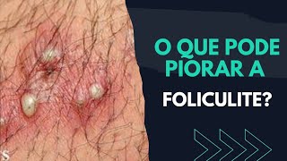 O QUE PODE PIORAR A FOLICULITE  SABIA [upl. by Akym516]