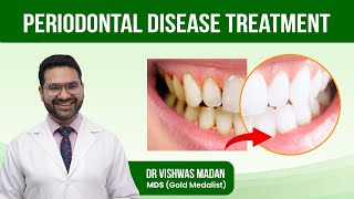 Periodontal Disease Treatment  GUM Disease  What is the Best Treatment for Periodontal Disease [upl. by Retrak]