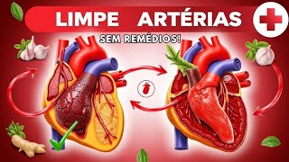 LIMPE AS ARTÉRIAS ENTUPIDAS NATURALMENTE SEM REMÉDIOS E SEM CIRURGIA [upl. by Alanah]