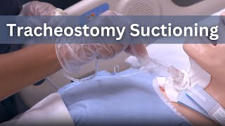 Tracheostomy Suctioning [upl. by Pincas]