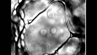 Chloroplasts do not have a polarity for lightinduced accumulation movement [upl. by Sorips]