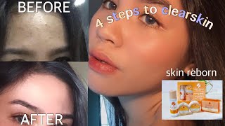 2 weeks TRIAL SKIN REBORN REJUVENATING SET HONEST REVIEW CLEAR SKIN for only P300  aloisa belle [upl. by Nonnel559]