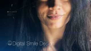 Dentcof  DSD Claudia [upl. by Eolhc]