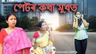 Petor kotha mukht  Assamese comedy video  Assamese funny video [upl. by Abixah]