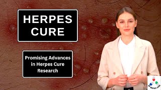 Herpes Cure Promising Advances in Herpes Cure Research [upl. by Niamart]