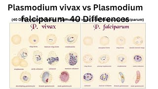 Plasmodium vivax vs Plasmodium falciparum 40 Differences [upl. by Stephine980]