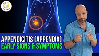 Appendicitis Early Signs amp Symptoms Appendix [upl. by Erusaert]