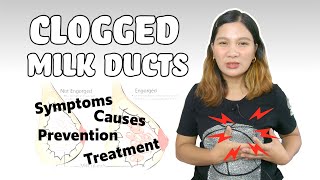 How to Treat Plugged or Clogged Milk Ducts  Causes Symptoms and Prevention  House Caraan [upl. by Barkley]