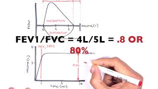 Understanding Spirometry  Normal Obstructive vs Restrictive [upl. by Kanor]