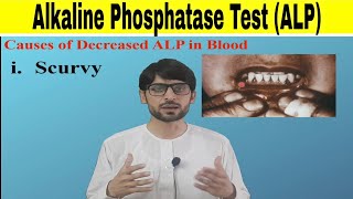 Alkaline Phosphatase Test ALP [upl. by Coleville990]