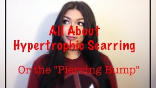 All About Hypertrophic Scarring Piercing Bump Piercing NativeBeauty [upl. by Harrat]