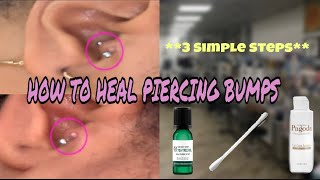 How To Get Rid Of Irritation Bumps On Tragus WORKS FOR ALL PIERCINGS [upl. by Mount]