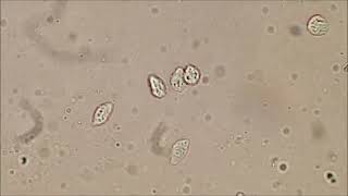 trichomonas vaginalis MLTsolutions [upl. by Argella]