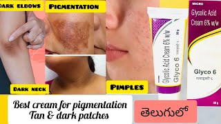 GLYCO 6 Cream review in telugu How to use Glycolic acidGlycolic acid cream [upl. by Odlabu385]