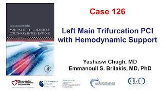 Case 126 PCI Manual  Trifurcation left main PCI [upl. by Sidnee]