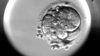 Timelapse of fertilisation of a human egg under the microscope [upl. by Enelrad]