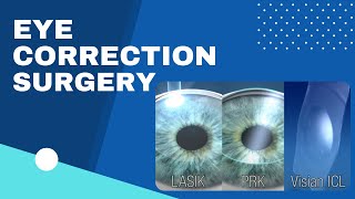 Eye Correction Surgery LASIK  PRK  VISIAN ICL [upl. by Nomled]