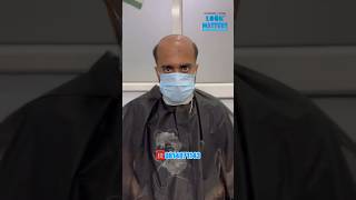 Best hair patch in Chandigarh hairpatch hairwig hairreplacement hairtransplant hairfixing [upl. by Adidnac]