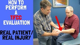 How to Perform a TFCC EvaluationReal patient real injury [upl. by Cathrine869]