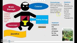 What is Galactosemia Causes Diagnosis Treatment Classic vs Galactokinase Deficiency USMLE NCLEX 3 M [upl. by Poppo]