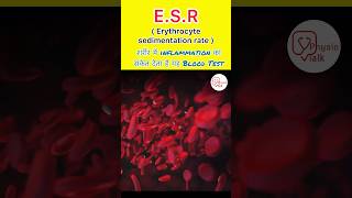 What is ESR test  Erythrocyte sedimentation rate test shorts ESR bloodtest [upl. by Ykcir]