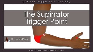 The Supinator Trigger Point [upl. by Adas]