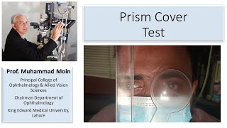 How to Perform Prism Cover Test [upl. by Millan]