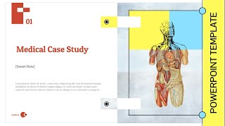 Medical Case Study Presentation  PowerPoint Template  O J Edits [upl. by Zack]