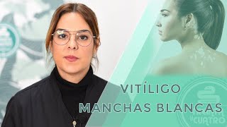 Manchas blancas en la piel VitÃ­ligo [upl. by Aliakam]