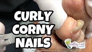 Cutting Curly Corny Nails [upl. by Garvin]