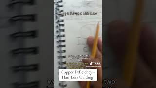 Copper Reverses Hair Loss [upl. by Purity]