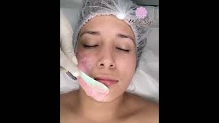 Tratamiento Facial Dermalaser Rejuvenece tu Piel con Tecnología Avanzada en Chiriquí y Santiago [upl. by Enwahs901]