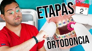 ETAPAS  FASES del tratamiento de BRACKETS ¿Cuanto TIEMPO DURA la ORTODONCIA [upl. by Eselahs]