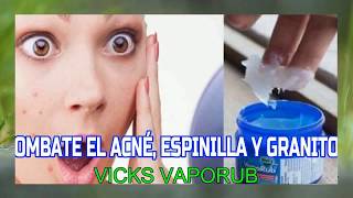 Una Mujer Embarazada Puede Echar Vaporub  Como Preparar El Vick Vaporub Para Quemar Grasa [upl. by Worrell901]