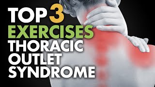 Top 3 Exercises for Thoracic Outlet Syndrome [upl. by Jehiel35]