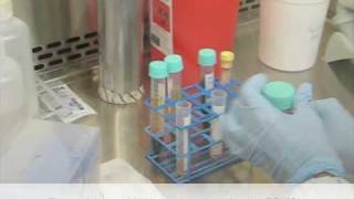 Isolation of peripheral blood mononuclear cells using ficoll1077 [upl. by Oile494]