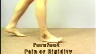 61 Flat Foot Gait  Calcaneal Gait  Pushoff Abnormalities  AOS Normal amp Abnormal Gaits [upl. by Jordans]