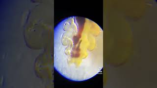 How Can You Tell Male amp Female Head Lice Apart licecenterswi licetok licetreatment [upl. by Bausch]