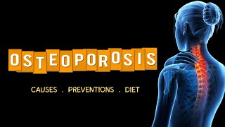 Osteoporosis Unveiled  Causes Prevention Cure amp 5 Alleviating Foods [upl. by Delphinia]